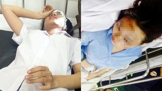 Liên tiếp các vụ nữ sinh bị tạt axit vì tình, tội ác tàn độc không thể dung tha