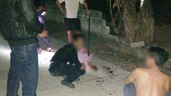 Trộm chó giữa đêm, nam thanh niên bị chém nát hai bàn tay