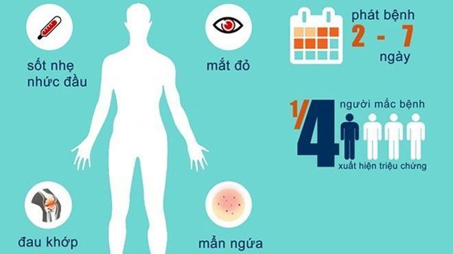 Hai người Việt Nam đầu tiên nhiễm virus Zika