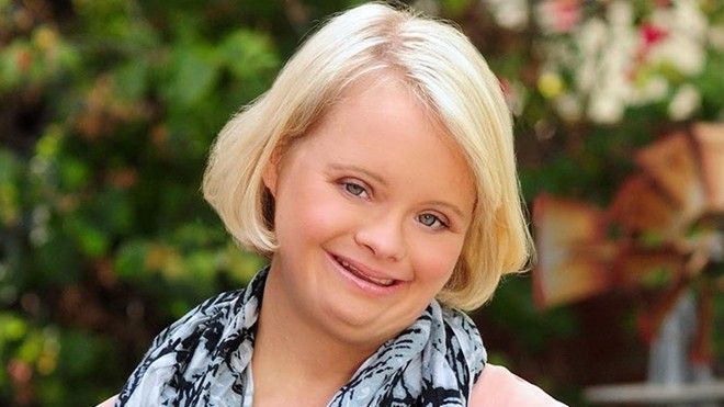 Lauren Potter - Bị Down vẫn là diễn viên truyền hình nổi tiếng