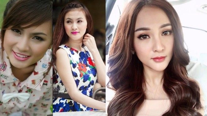 Kelly chấp nhận mất gần 200 triệu để sang Hàn phẫu thuật lại cằm lần thứ 6