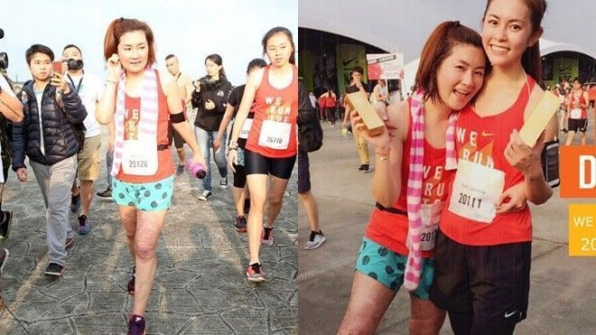 Selina lần đầu lộ chân sẹo sau khi bỏ chồng