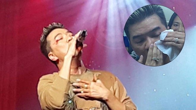 Đàm Vĩnh Hưng bất ngờ gặp tai nạn chảy máu mắt trên sân khấu