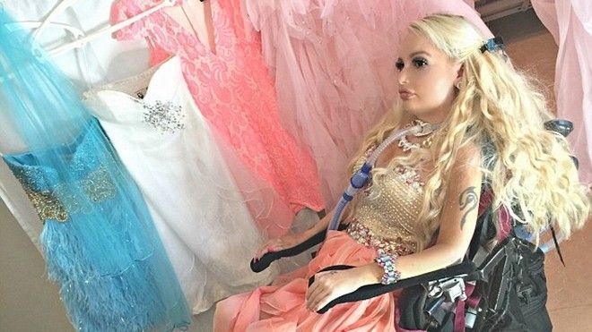 Cô gái liệt tứ chi sẵn sàng chi hàng trăm triệu để được giống thần tượng