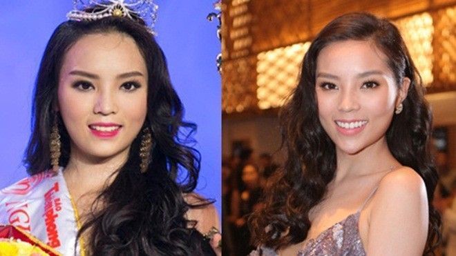 Thực hư về chiếc cằm thon gọn bất ngờ của hoa hậu Kỳ Duyên