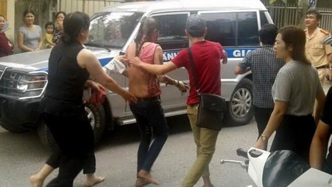 Nghi vấn ghen tuông, người phụ nữ bị tạt xăng đốt cháy mặt