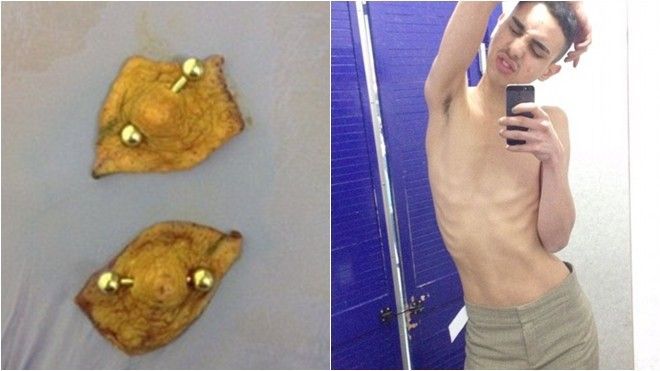 Kỳ quái phẫu thuật cắt núm vú và rốn làm khuyên tai bán đấu giá trên mạng