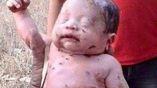 Em bé sống sót kỳ diệu sau khi bị đâm 14 nhát dao và chôn sống