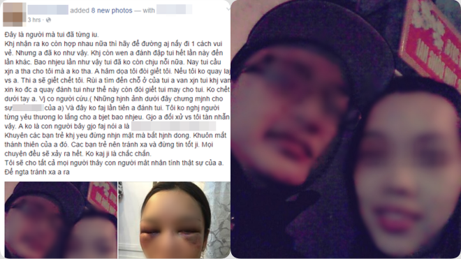 Cô gái trẻ bị người yêu đánh bầm dập mặt vì níu kéo không thành