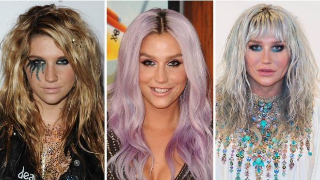 Cuộc cách mạng làm đẹp của 'gái hư' Kesha