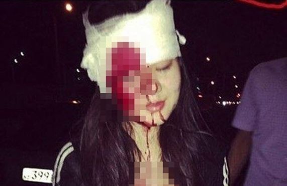 Mỹ nữ chụp ảnh làm màu trên xế hộp với bạn trai và cái kết kinh hoàng