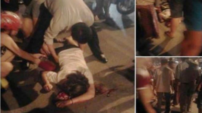 Bị giật túi xách trên đường Hà Nội, cô gái trẻ phải khâu chục mũi ở đầu