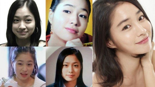 Những nghệ sĩ là bằng chứng cho thấy 'đẹp nhân tạo hơn xấu tự nhiên'