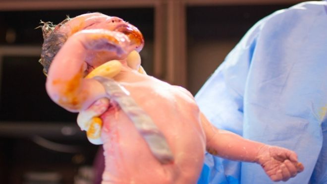 Nữ nhiếp ảnh gia tự chụp hành trình 'vượt cạn' của mình