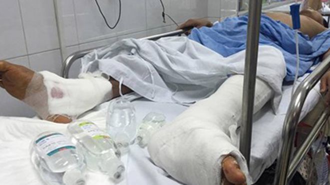 Bệnh nhân bị mổ nhầm chân xin giảm nhẹ kỷ luật cho bác sĩ