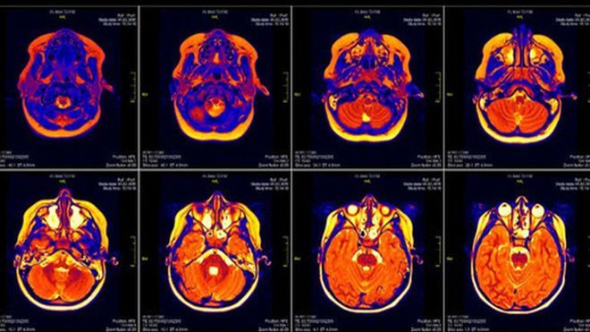 Một lỗi phần mềm nhỏ có thể khiến 15 năm công sức nghiên cứu của các nhà khoa học đổ xuống sông xuống biển