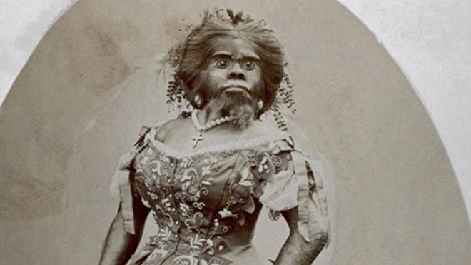 Bi kịch người phụ nữ 'xấu nhất thế giới, chết cũng không yên khi bị chồng lôi ra trưng bày kiếm tiền