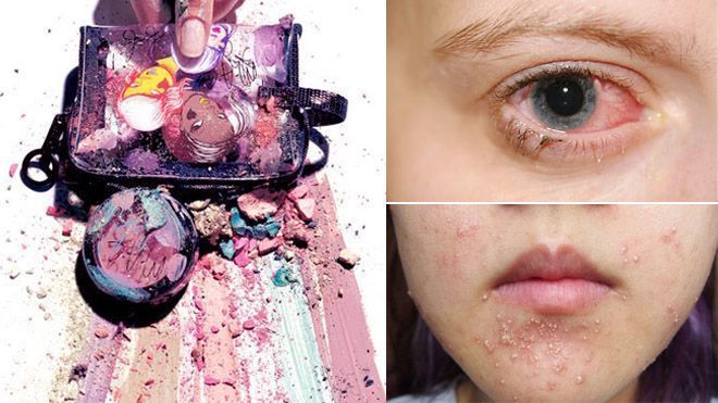 Những thảm họa không tưởng cho da khi bảo quản mỹ phẩm sai cách
