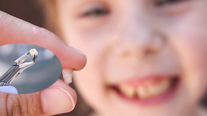 Đừng vứt răng sữa bởi chúng có thể cứu mạng con bạn trong tương lai