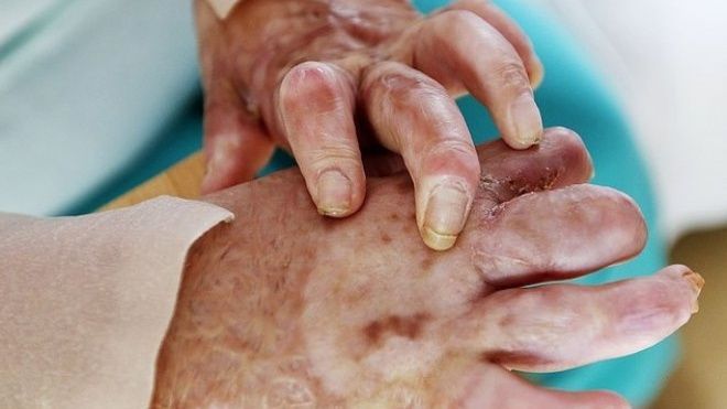 Thiếu nữ xinh đẹp tự hủy dung nhan, hóa quỷ để không phải phục vụ IS