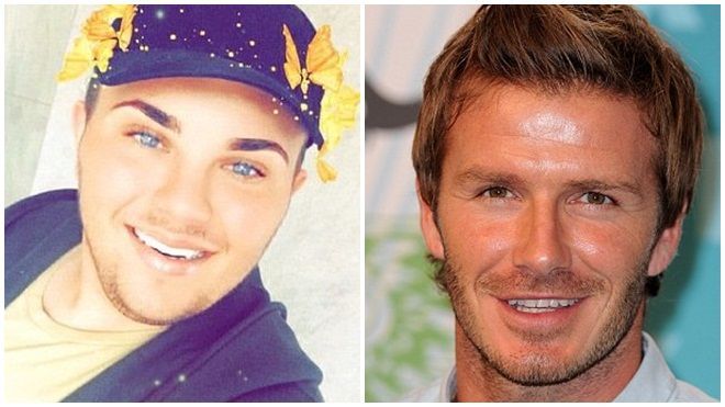 Dồn tiền phẫu thuật để giống David Beckham và phản ứng phũ phàng của cư dân mạng