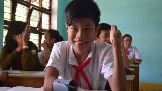Mất đôi bàn tay do bom mìn, cậu bé dùng ống nhựa viết bài