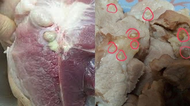 Sán 'chọc' thủng mắt, 'đâm' vào tim: Đây là hậu quả kinh hoàng của thói quen ăn 'vô tội vạ'