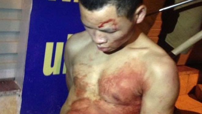 Người dân bắt sống kẻ đâm thủng cổ tài xế taxi trong đêm