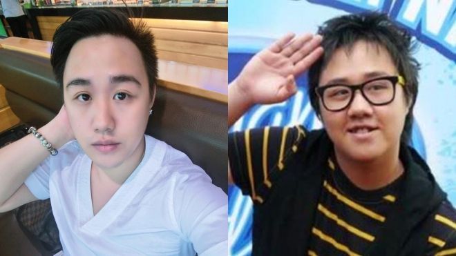 'Thánh mưa' Trung Quân niềng răng, giảm cân 'lột xác' đến ngỡ ngàng