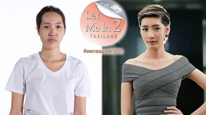 Nối tiếp Hàn Quốc, Thái Lan thực hiện chương trình truyền hình về phẫu thuật thẩm mỹ!