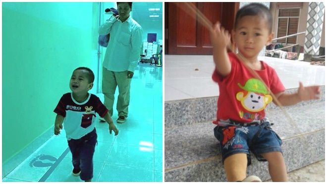 Bé trai 'văng khỏi bụng mẹ' chạy trên chân giả ở tuổi lên 2