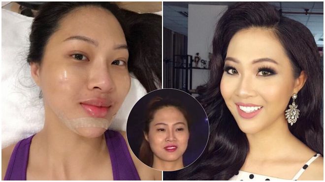 Trước giờ đi Miss World, Hoa khôi Diệu Ngọc bất ngờ bị tố phẫu thuật thẩm mỹ