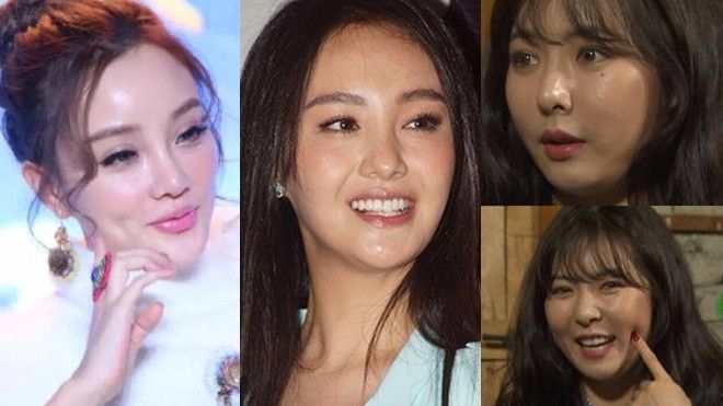 Nghiện botox, các mỹ nhân Châu Á đã tự hủy hoại nhan sắc của mình như thế này!