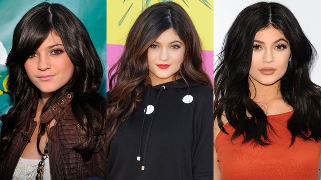 Sự thay đổi gương mặt của Kylie Jenner qua từng thời kì