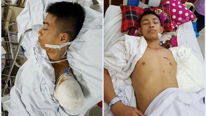 Chàng trai xứ Nghệ bất chấp nguy hiểm để ô tô cán qua tay mình cứu sống bạn?