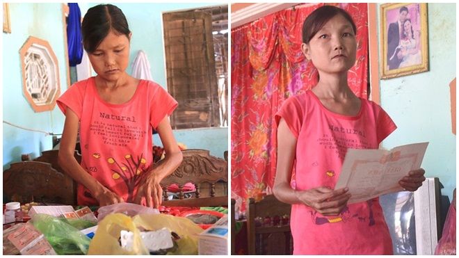 Cô gái mang khuôn mặt bà lão ở Quảng Nam: Ăn gấp 10 lần người thường, uống mỗi ngày 36 lít nước