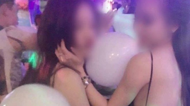 Cô gái trẻ bị nghi tổn thương não, ngây ngô như đứa trẻ do hút bóng cười