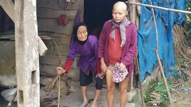 Mẹ già 92 tuổi lo trước khi chết không có quan tài cho con gái tâm thần