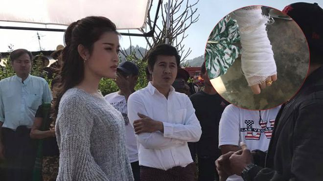 Sự thật về chấn thương của Á hậu Huyền My khi quay hình tại Myanmar