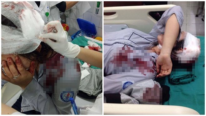 Hà Nội: Trả thù nhầm, 3 thanh niên hành hung dã man nữ sinh THPT