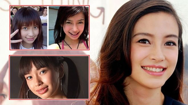 Chỉ nhờ niềng răng mà sao Hoa ngữ đã khác trước 'một trời một vực' thế này