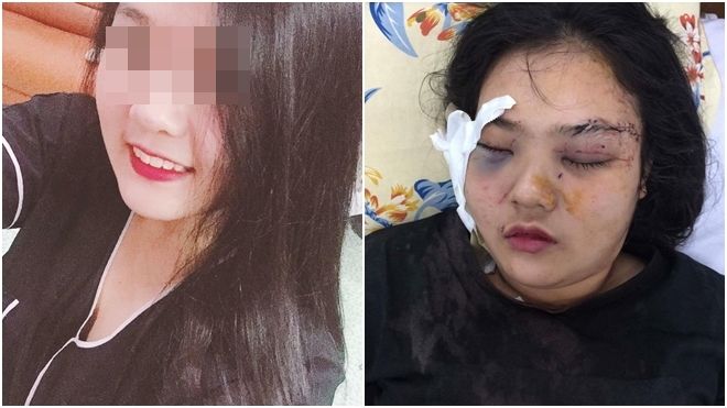 Nữ sinh bị 20 thanh niên hành hung dã man sau khi tố giác tội phạm