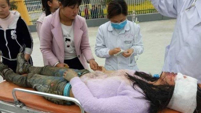 Nữ sinh trung học bị kẻ hiếp dâm tấn công đến mù mắt trên đường đi học