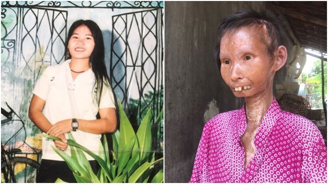 Nàng sơn nữ biến thành bà già vì bệnh lạ