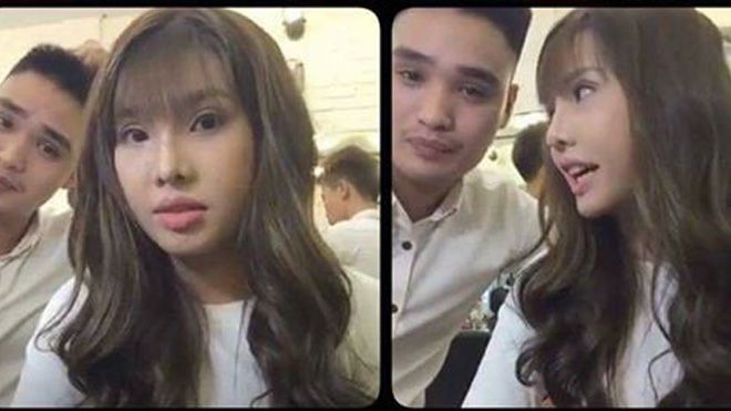 Nhan sắc mới nhất của cô gái quyết tâm phẫu thuật vì bị chê 'xấu như Thị Nở'