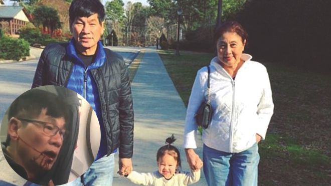 Bác sĩ bị kéo lê trên máy bay United Airlines là người Mỹ gốc Việt