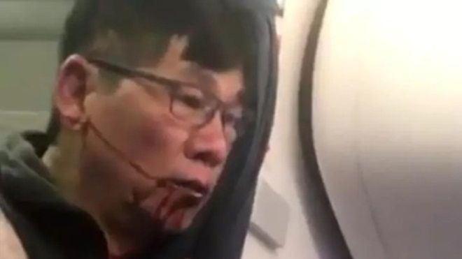 United Airlines đạt thỏa thuận bồi thường với David Dao