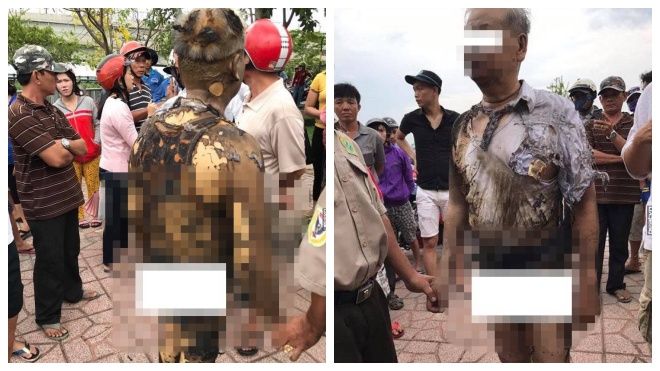 Đồng Nai: Cụ ông 70 tuổi dùng xăng tự thiêu vì bệnh tật, không muốn phiền hà con cháu