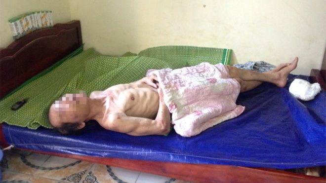 Sự thật về vụ cha già 67 tuổi bị con gái và con rể đánh đập, bỏ đói dưới nền nhà lạnh