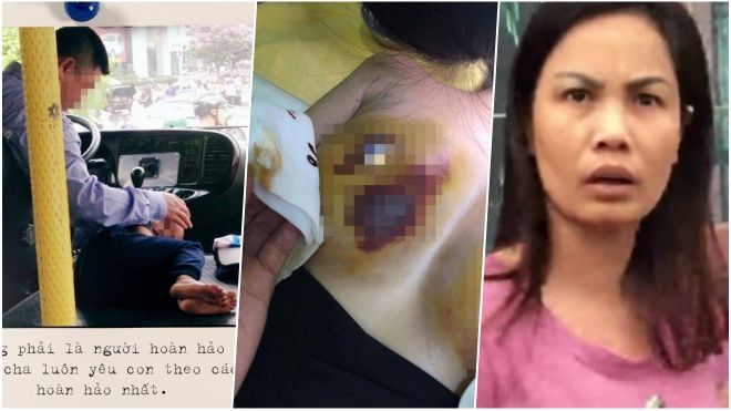 Hot nhất tuần: Mạo danh nhà báo lăng mạ CSGT, chi 300 triệu nhận được bộ ngực biến dạng